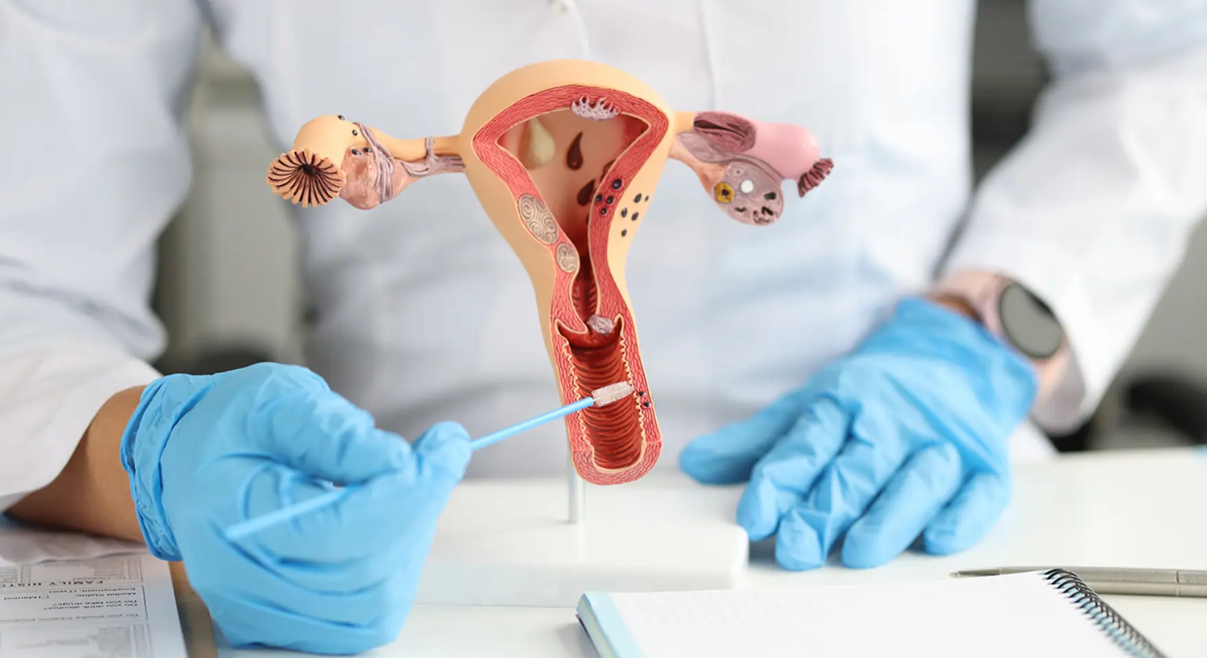 Gyne and Obs